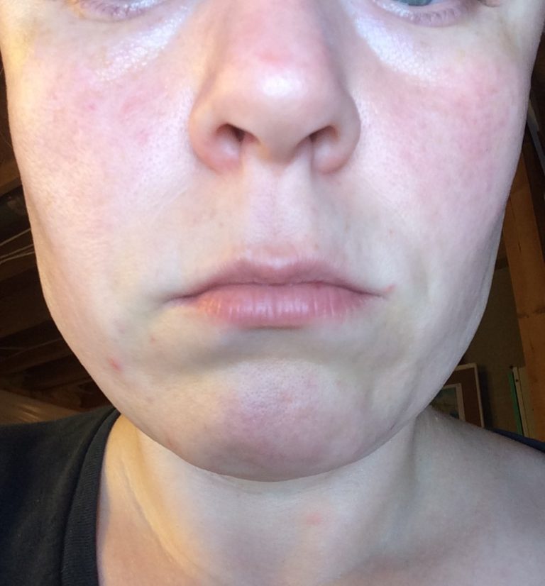is infrared the same as red light therapy for face